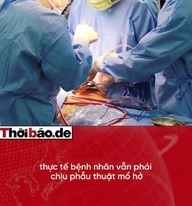 ĐẮK LẮK: HÀNG TRĂM CA TÁN SỎI “MA” KHI MÁY NẰM PHỦ BỤI